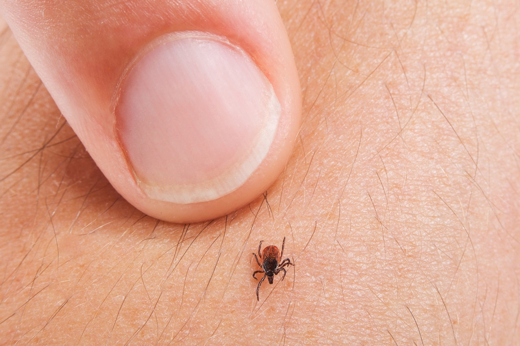 Eine Zecke krabbelt auf der Haut ©Pfizer/www.zecken.de 